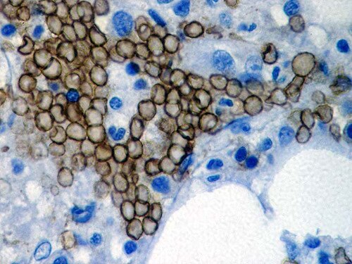 IHC of Glycophorin A on an FFPE Bone Marrow Tissue